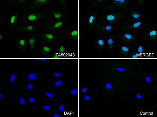 CDK2 Antibody in Immunocytochemistry (ICC/IF)