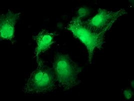 CDK2 Antibody in Immunocytochemistry (ICC/IF)