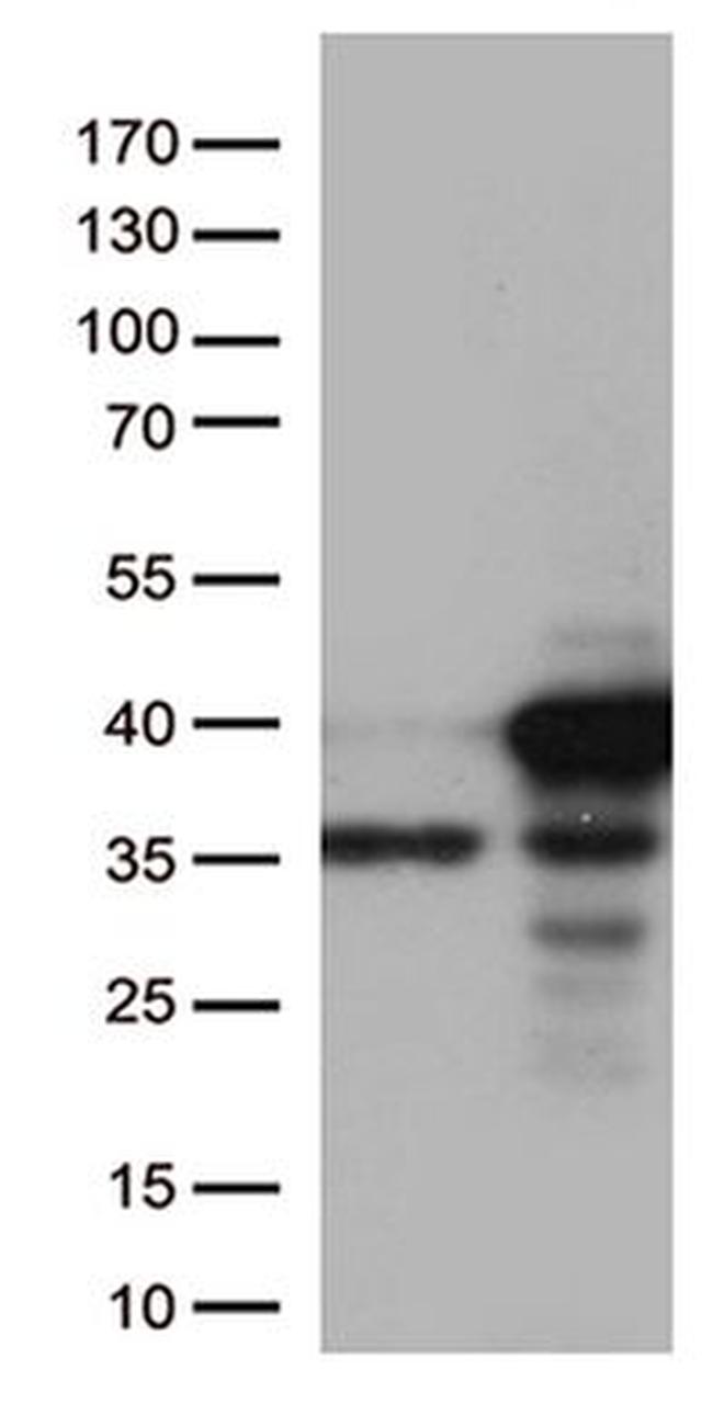 CDK2 Antibody in Western Blot (WB)