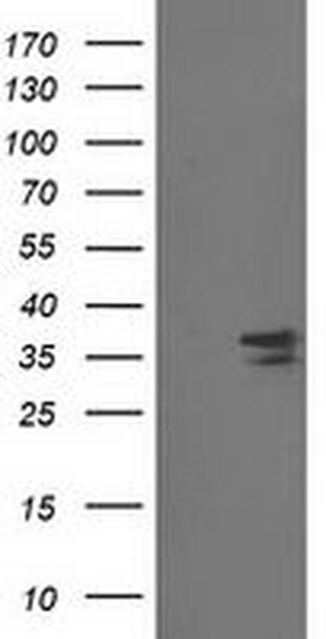 CDK2 Antibody in Western Blot (WB)