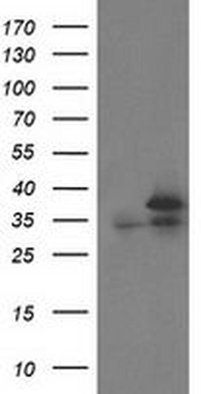 CDK2 Antibody in Western Blot (WB)