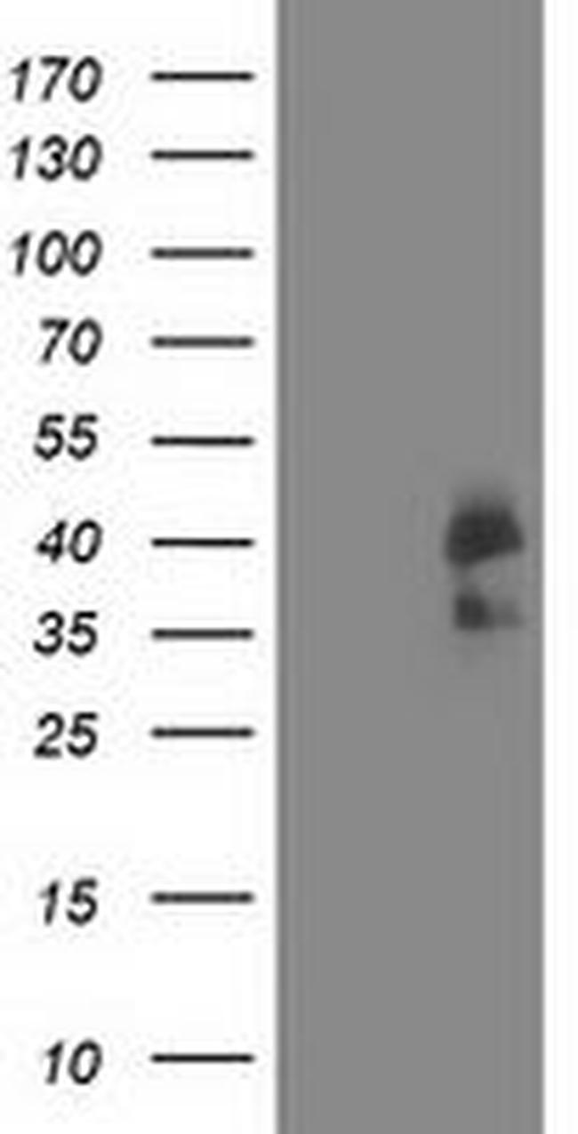 CDK2 Antibody in Western Blot (WB)