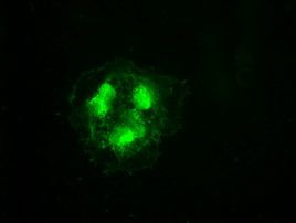 CDK5 Antibody in Immunocytochemistry (ICC/IF)