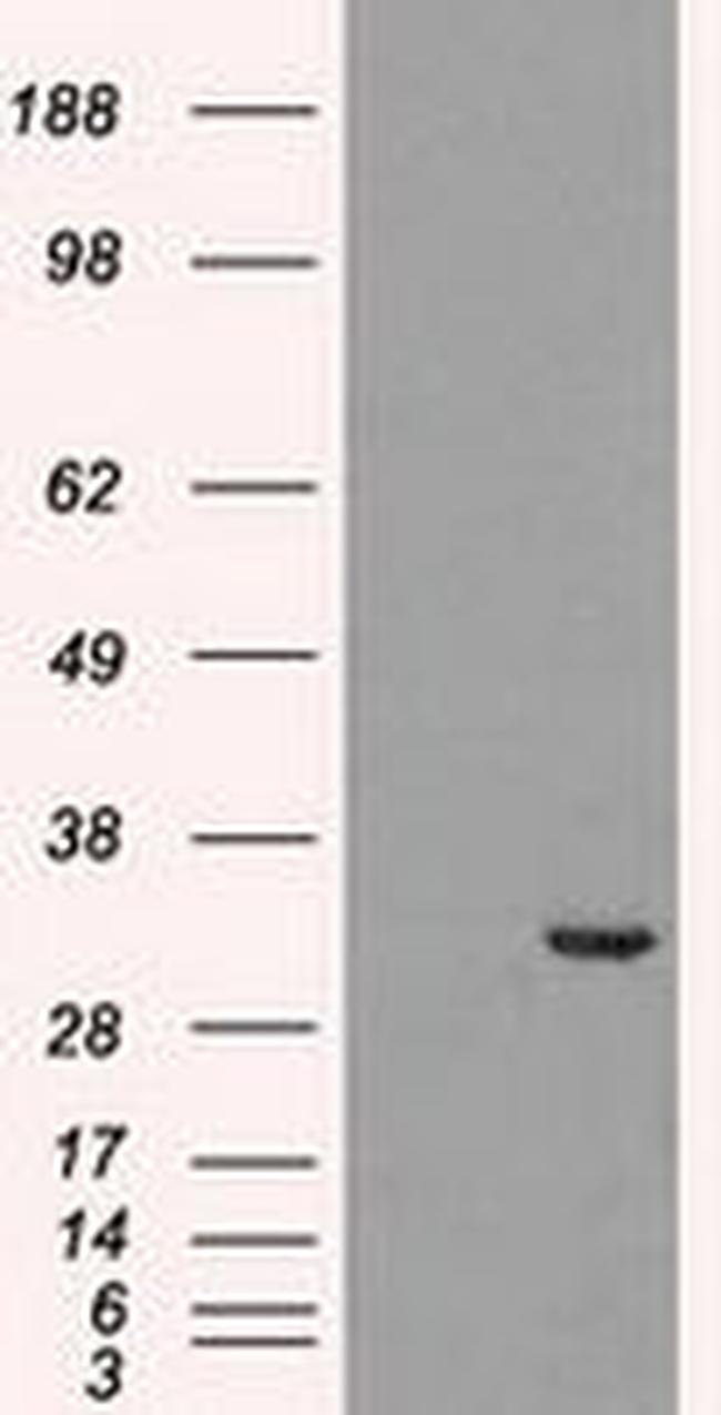 CDK5 Antibody in Western Blot (WB)