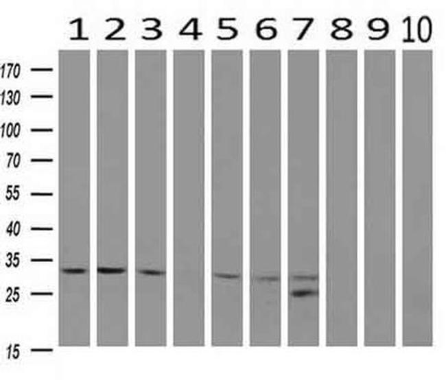 CDK5 Antibody in Western Blot (WB)