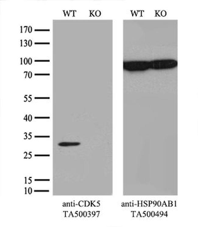 CDK5 Antibody in Western Blot (WB)