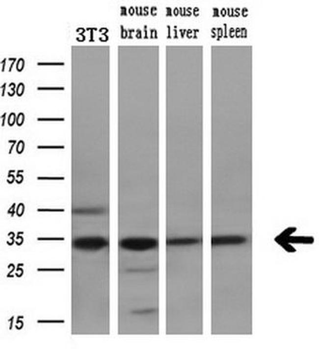 CDK5 Antibody in Western Blot (WB)