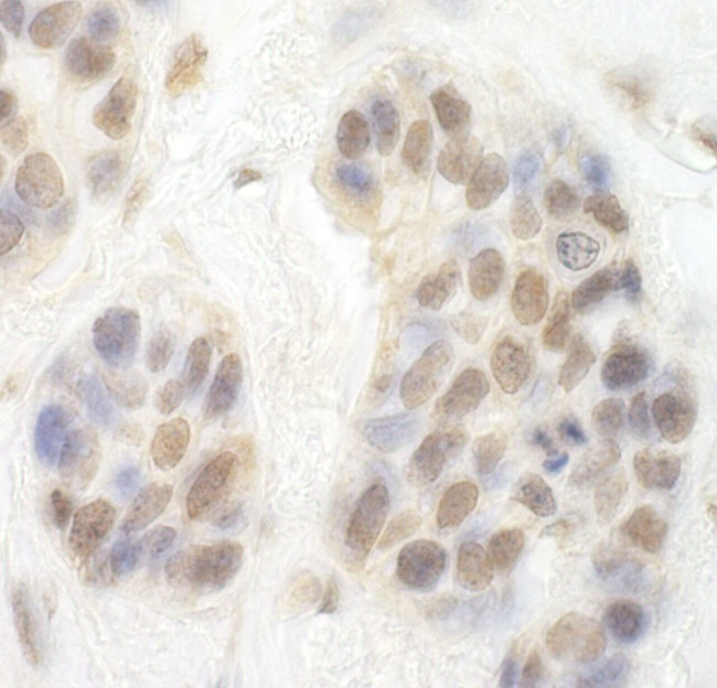 CDK8 Antibody in Immunohistochemistry (IHC)