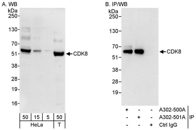 CDK8 Antibody in Western Blot (WB)