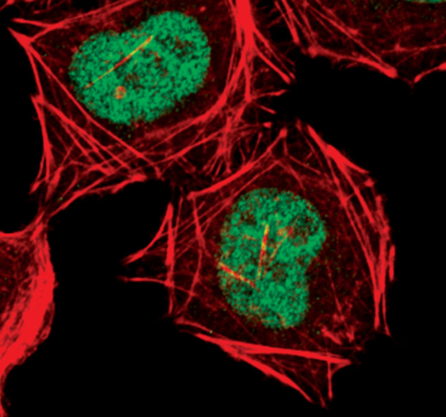 CDK9 Antibody in Immunocytochemistry (ICC/IF)