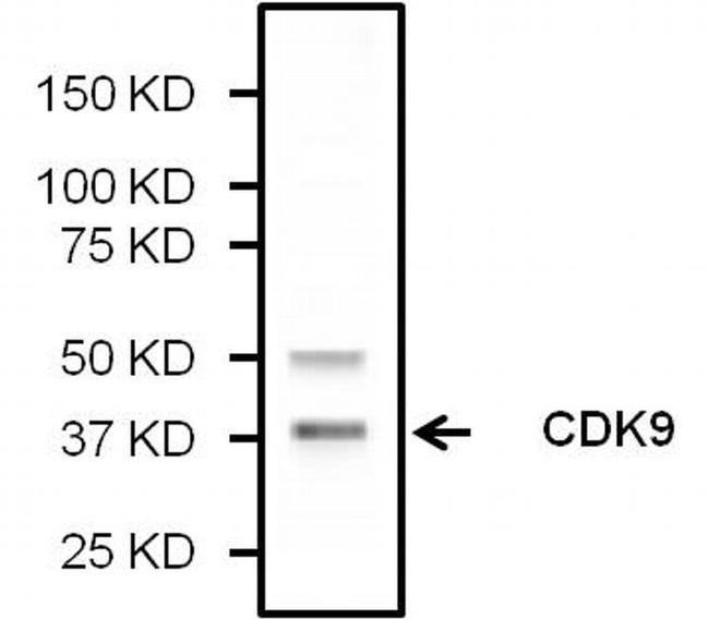 CDK9 Antibody in Western Blot (WB)