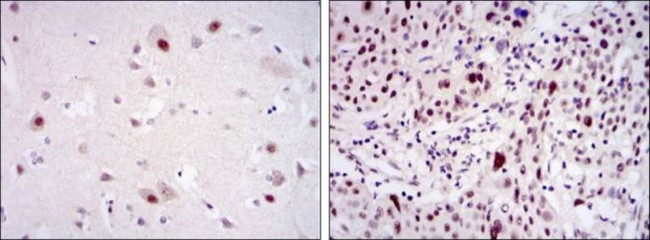 CDK9 Antibody in Immunohistochemistry (Paraffin) (IHC (P))