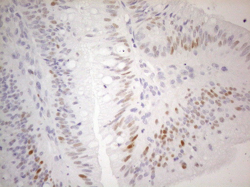 CDKN1A Antibody in Immunohistochemistry (Paraffin) (IHC (P))