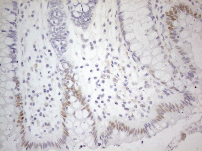 CDKN1A Antibody in Immunohistochemistry (Paraffin) (IHC (P))