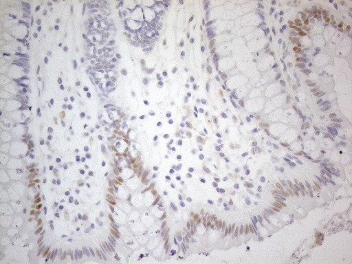 CDKN1A Antibody in Immunohistochemistry (Paraffin) (IHC (P))