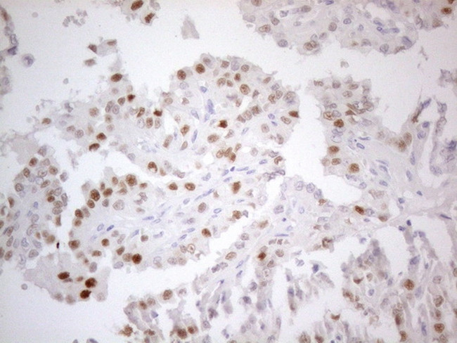 CDKN1A Antibody in Immunohistochemistry (Paraffin) (IHC (P))