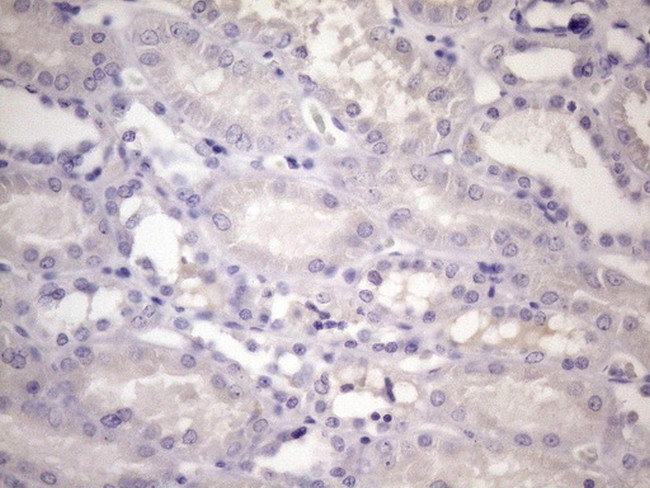 CDKN1A Antibody in Immunohistochemistry (Paraffin) (IHC (P))