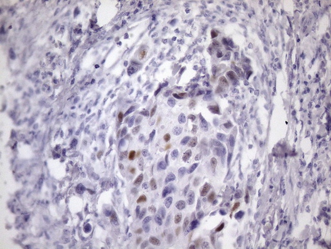 CDKN1A Antibody in Immunohistochemistry (Paraffin) (IHC (P))