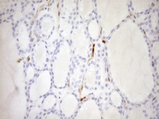 CDKN2A Antibody in Immunohistochemistry (Paraffin) (IHC (P))