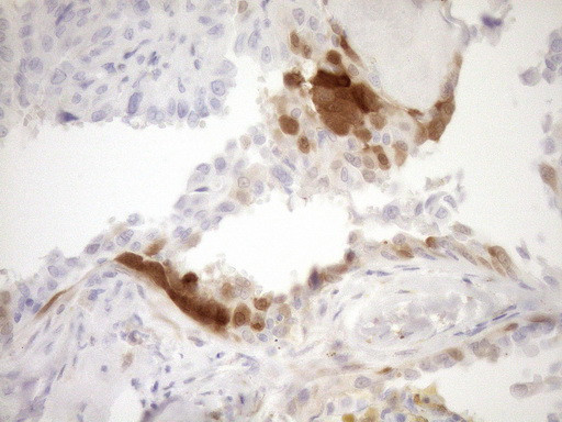 CDKN2A Antibody in Immunohistochemistry (Paraffin) (IHC (P))