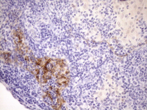 CDKN2A Antibody in Immunohistochemistry (Paraffin) (IHC (P))