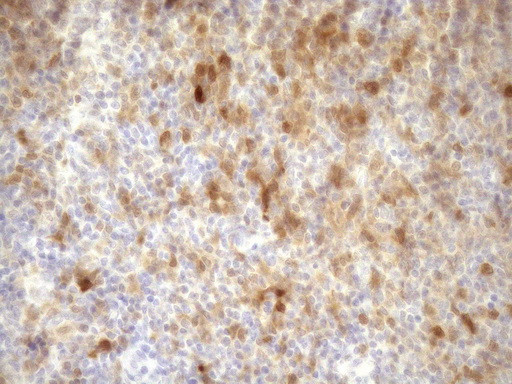 CDKN2A Antibody in Immunohistochemistry (Paraffin) (IHC (P))