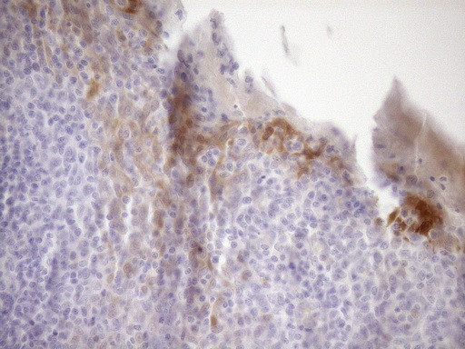 CDKN2A Antibody in Immunohistochemistry (Paraffin) (IHC (P))