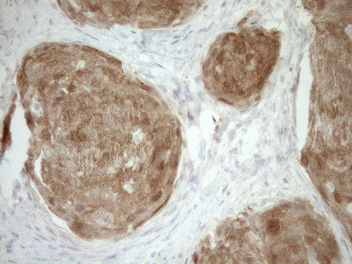 CDKN2A Antibody in Immunohistochemistry (Paraffin) (IHC (P))