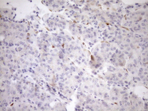 CDKN2A Antibody in Immunohistochemistry (Paraffin) (IHC (P))