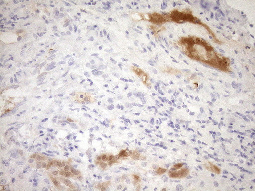 CDKN2A Antibody in Immunohistochemistry (Paraffin) (IHC (P))