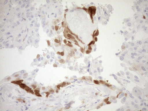 CDKN2A Antibody in Immunohistochemistry (Paraffin) (IHC (P))