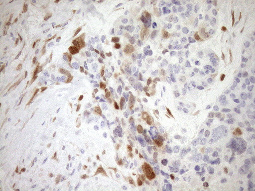 CDKN2A Antibody in Immunohistochemistry (Paraffin) (IHC (P))