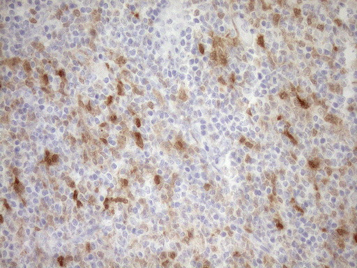 CDKN2A Antibody in Immunohistochemistry (Paraffin) (IHC (P))