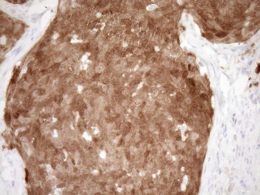 CDKN2A Antibody in Immunohistochemistry (Paraffin) (IHC (P))