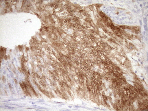 CDKN2A Antibody in Immunohistochemistry (Paraffin) (IHC (P))