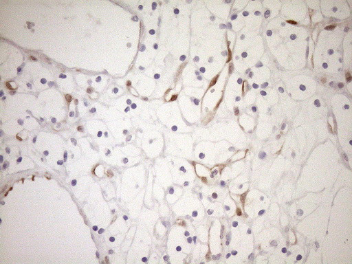 CDKN2A Antibody in Immunohistochemistry (Paraffin) (IHC (P))