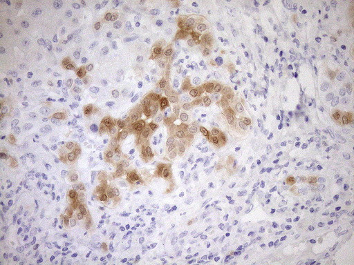 CDKN2A Antibody in Immunohistochemistry (Paraffin) (IHC (P))