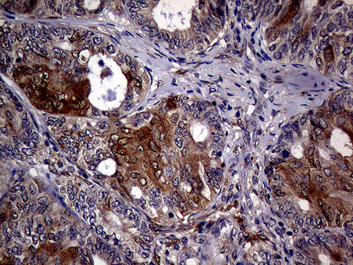 CDKN2A Antibody in Immunohistochemistry (Paraffin) (IHC (P))