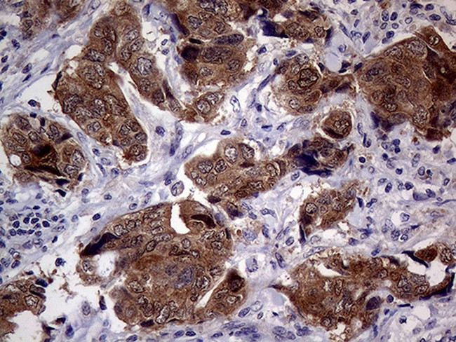 CDKN2A Antibody in Immunohistochemistry (Paraffin) (IHC (P))