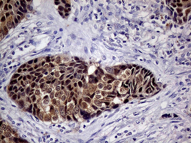 CDKN2A Antibody in Immunohistochemistry (Paraffin) (IHC (P))