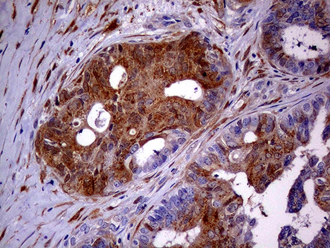 CDKN2A Antibody in Immunohistochemistry (Paraffin) (IHC (P))