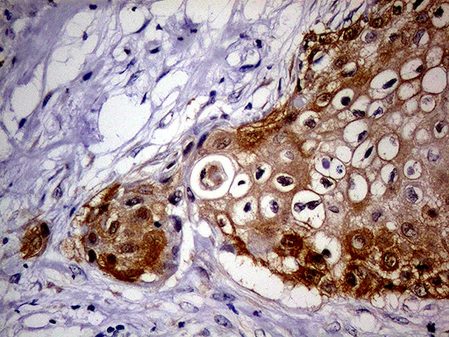 CDKN2A Antibody in Immunohistochemistry (Paraffin) (IHC (P))