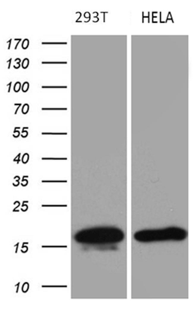 CDKN2A Antibody in Western Blot (WB)