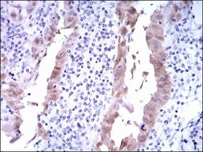 p16INK4a Antibody in Immunohistochemistry (Paraffin) (IHC (P))