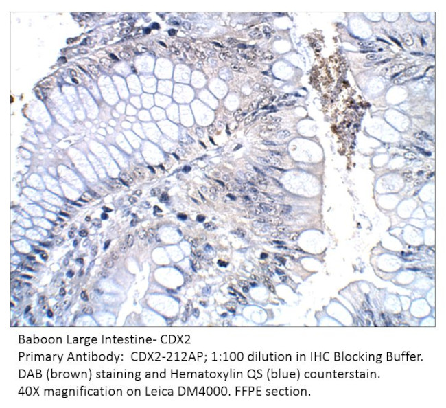 CDX2 Antibody in Immunohistochemistry (IHC)