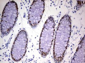 CDX2 Antibody in Immunohistochemistry (Paraffin) (IHC (P))