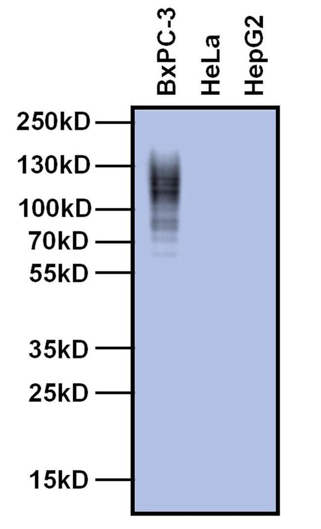 CEA Antibody in Western Blot (WB)