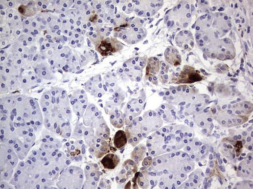 CEA (CEACAM5) Antibody in Immunohistochemistry (Paraffin) (IHC (P))