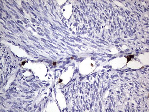 CEA (CEACAM5) Antibody in Immunohistochemistry (Paraffin) (IHC (P))