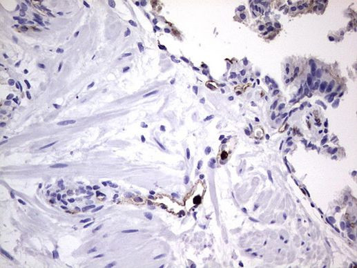 CEA (CEACAM5) Antibody in Immunohistochemistry (Paraffin) (IHC (P))